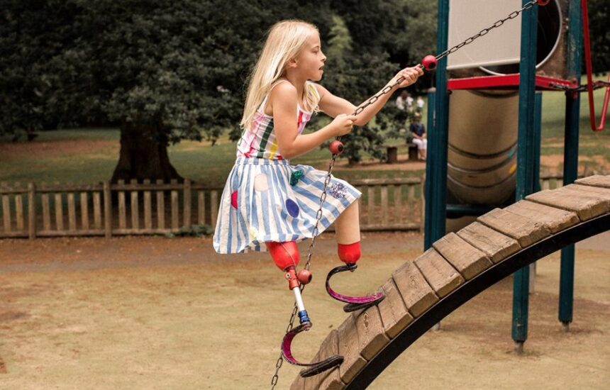 Photo of a girl with prosthetic legs climbing on playground equipment